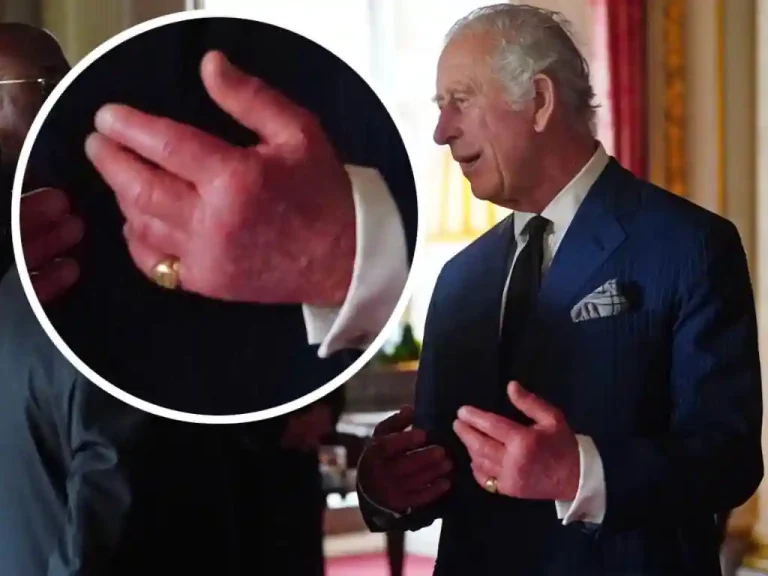 Royal Shock: King Charles’ Swollen Hands Spark Health Concerns